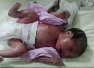 保定助孕公司哪家排名第一？武汉三大助孕机构介绍