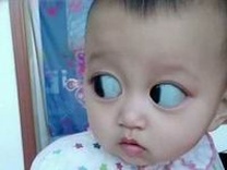 青岛试管婴儿的费用是多少？